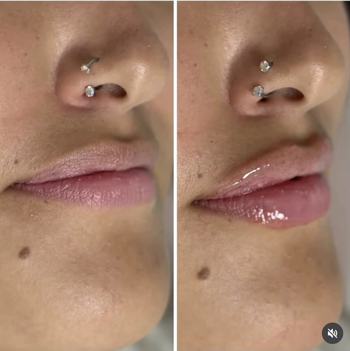 Jerrika Patient Results 1