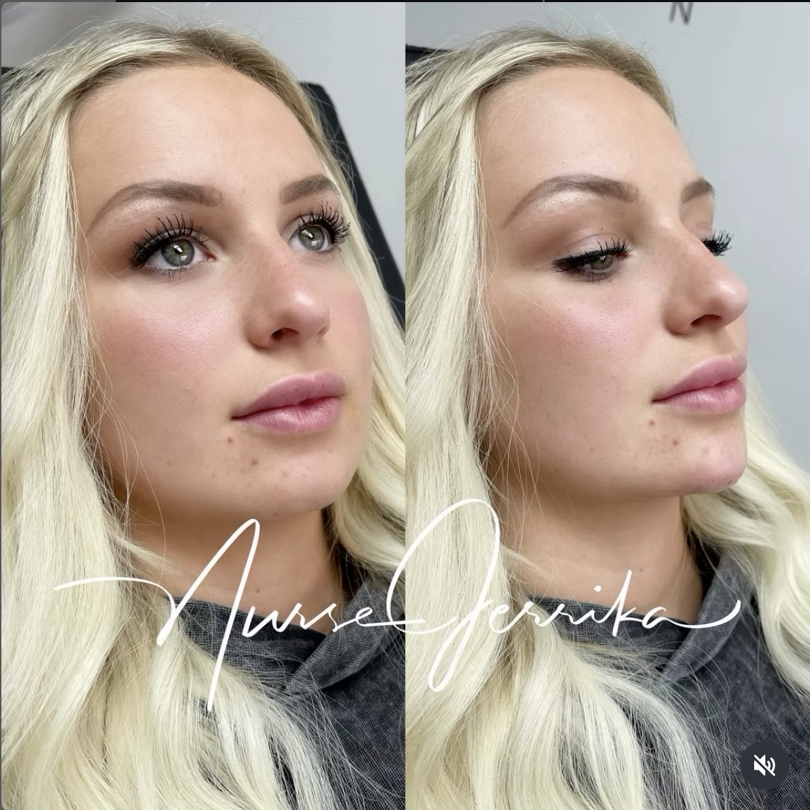 Jerrika Patient Results 2