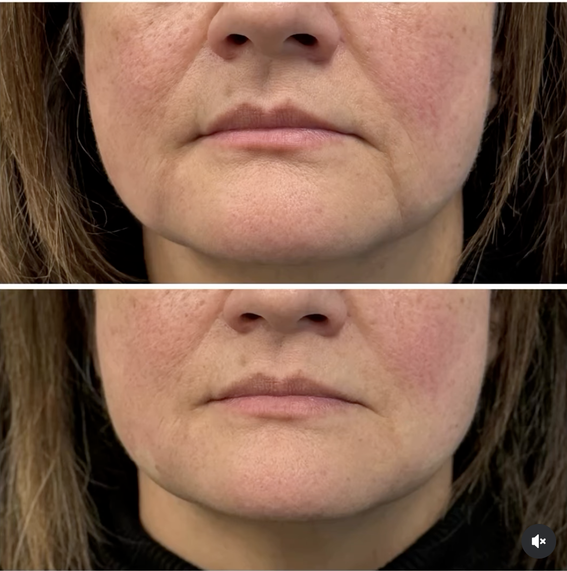 Jerrika Patient Results 3