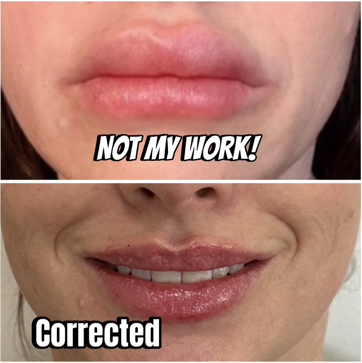 Jerrika Patient Results 4