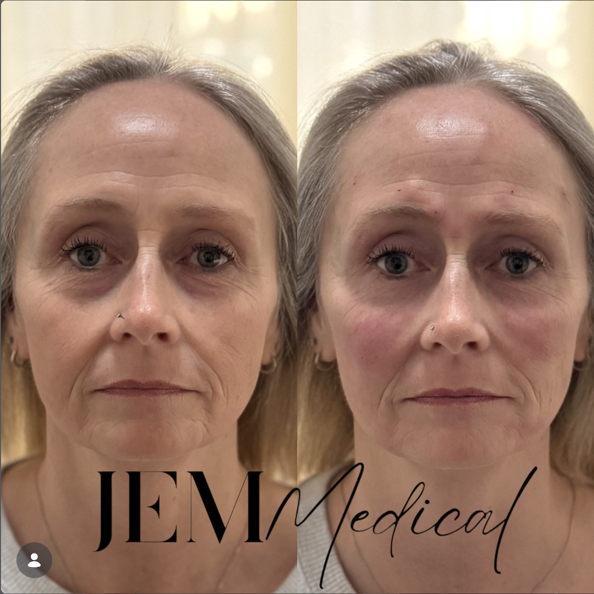 Jerrika Patient Results 5