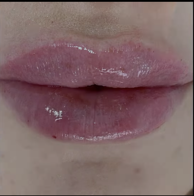 Jerrika Patient Results 6