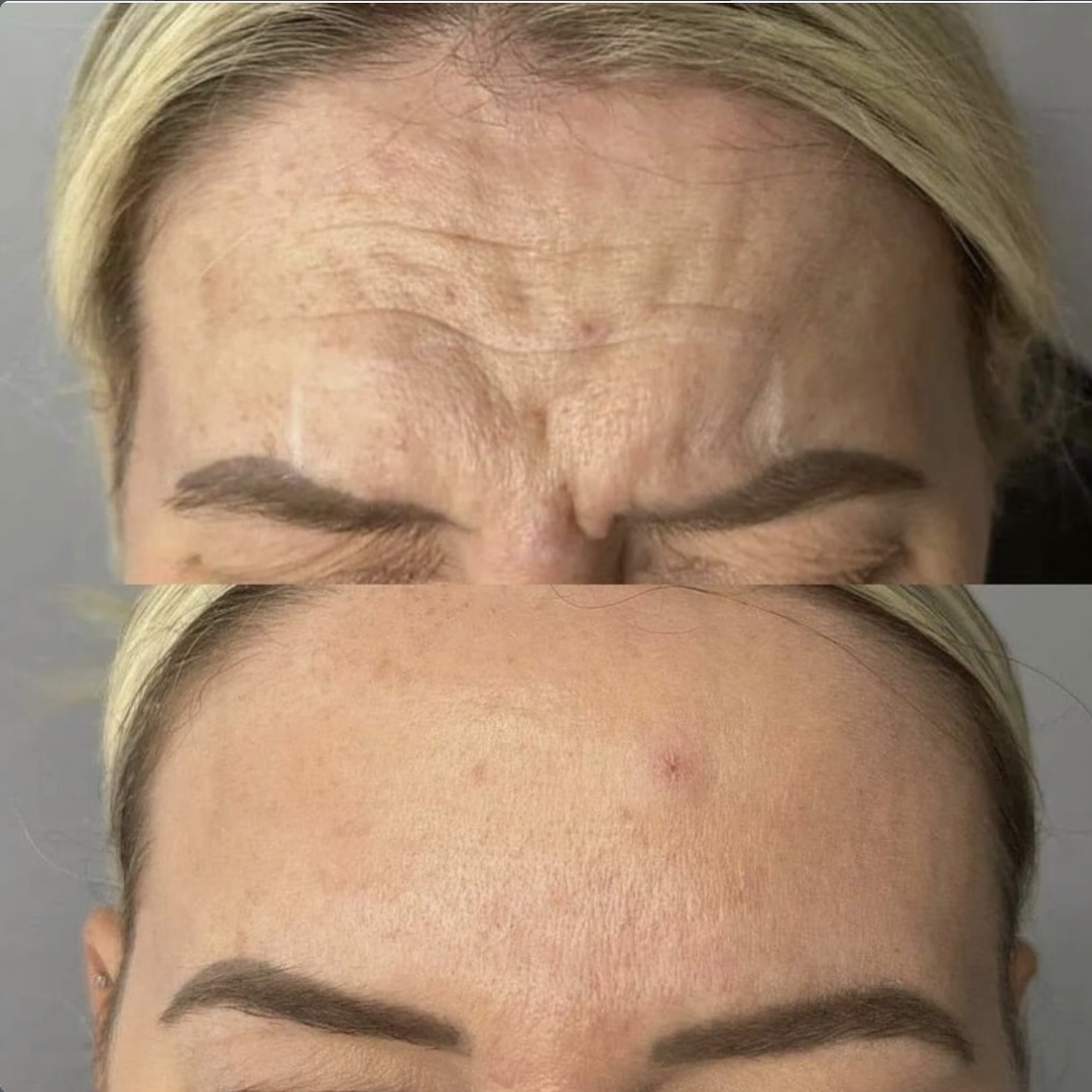 Jerrika Patient Results 7