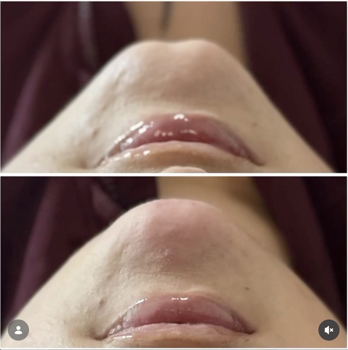 Jerrika Patient Results 8