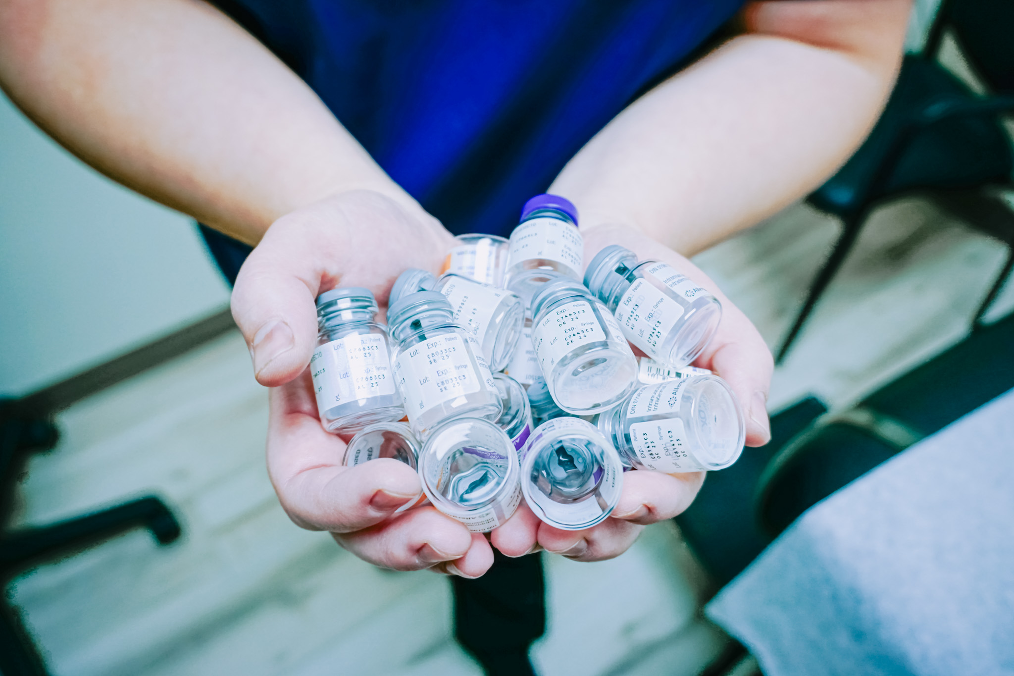 Dermal filler treatment