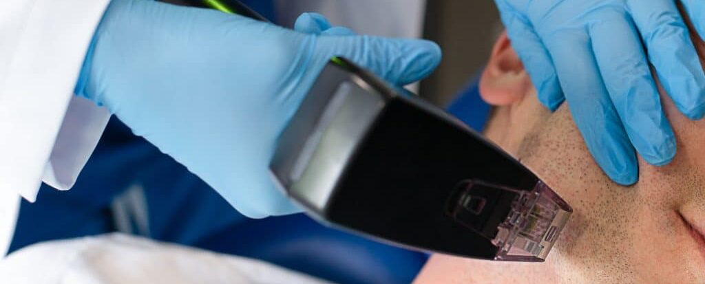 Skin rejuvenation Morpheus8 treatment